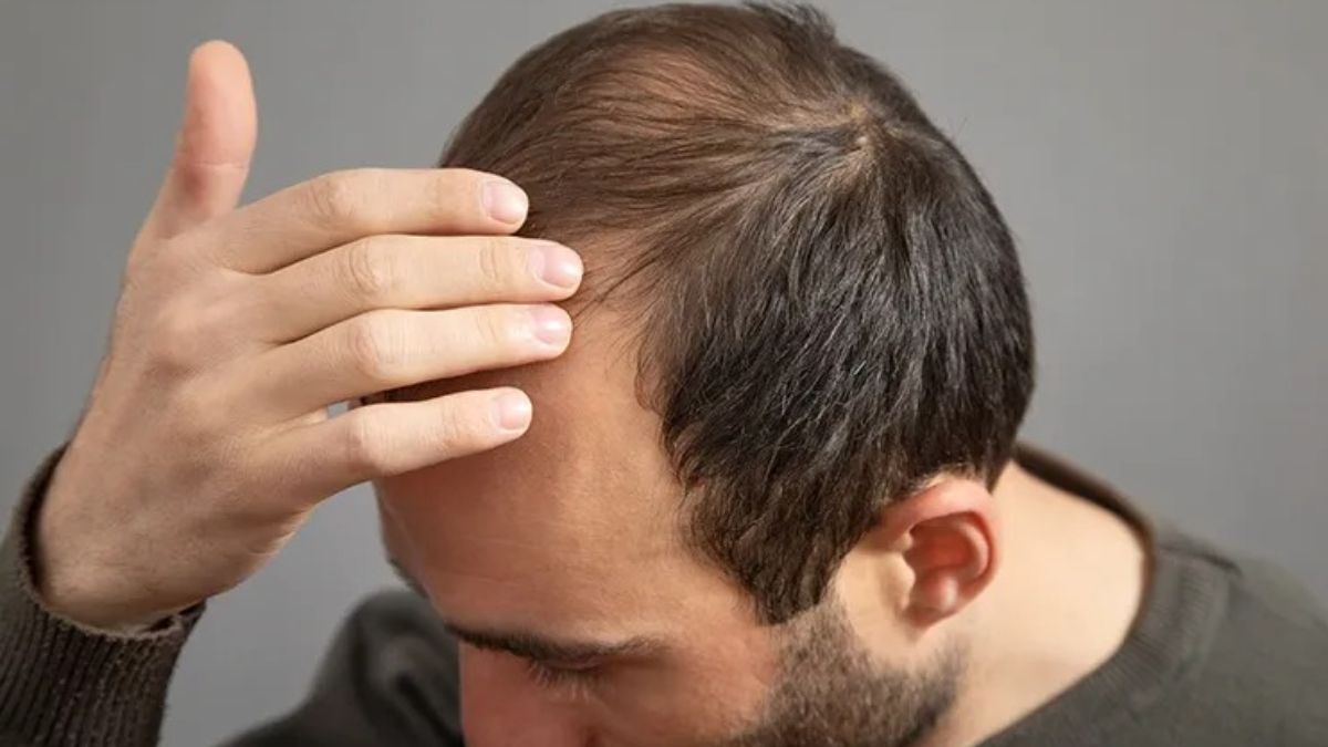 Dr Batra’s® Healthcare Introduces World’s Most Advanced Treatment for Targeted Hereditary Hair Loss: XOGEN